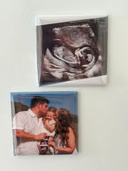 Ultrasound Photo Magnet